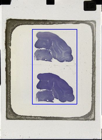 Media type: image; Special Collections 3043   shows specimen_part histological serial section;